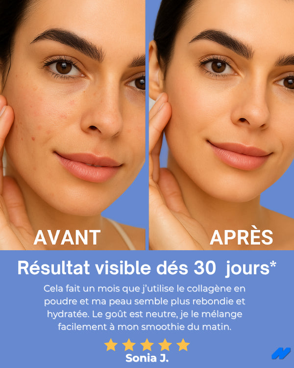 Nutralpes® Collagène Marin Pur & Naturel 10 000 mg – Peau, Cheveux, Ongles, Articulations – Sans Saveur – 300 g (1 Mois / 60 Portions)