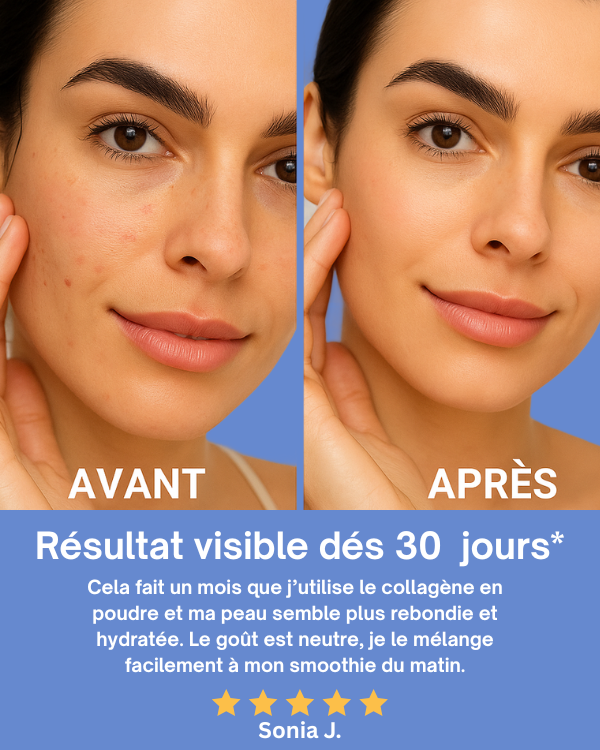 Collagène Marin Premium Pur 10 000 mg – Complément Alimentaire Beauté Peau, Cheveux & Articulations | Nutralpes – Corail